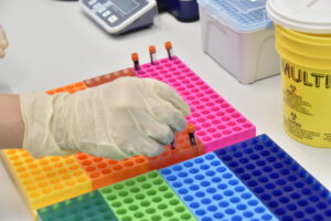 Čo sa deje s vašou vzorkou po odbere: životný cyklus biologickej vzorky